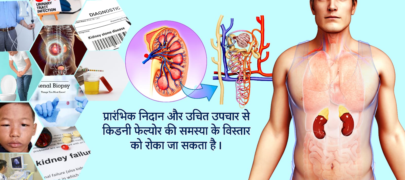 प्रारंभिक निदान और उचित उपचार से किडनी फेल्योर की समस्या के विस्तार को रोका जा सकता है