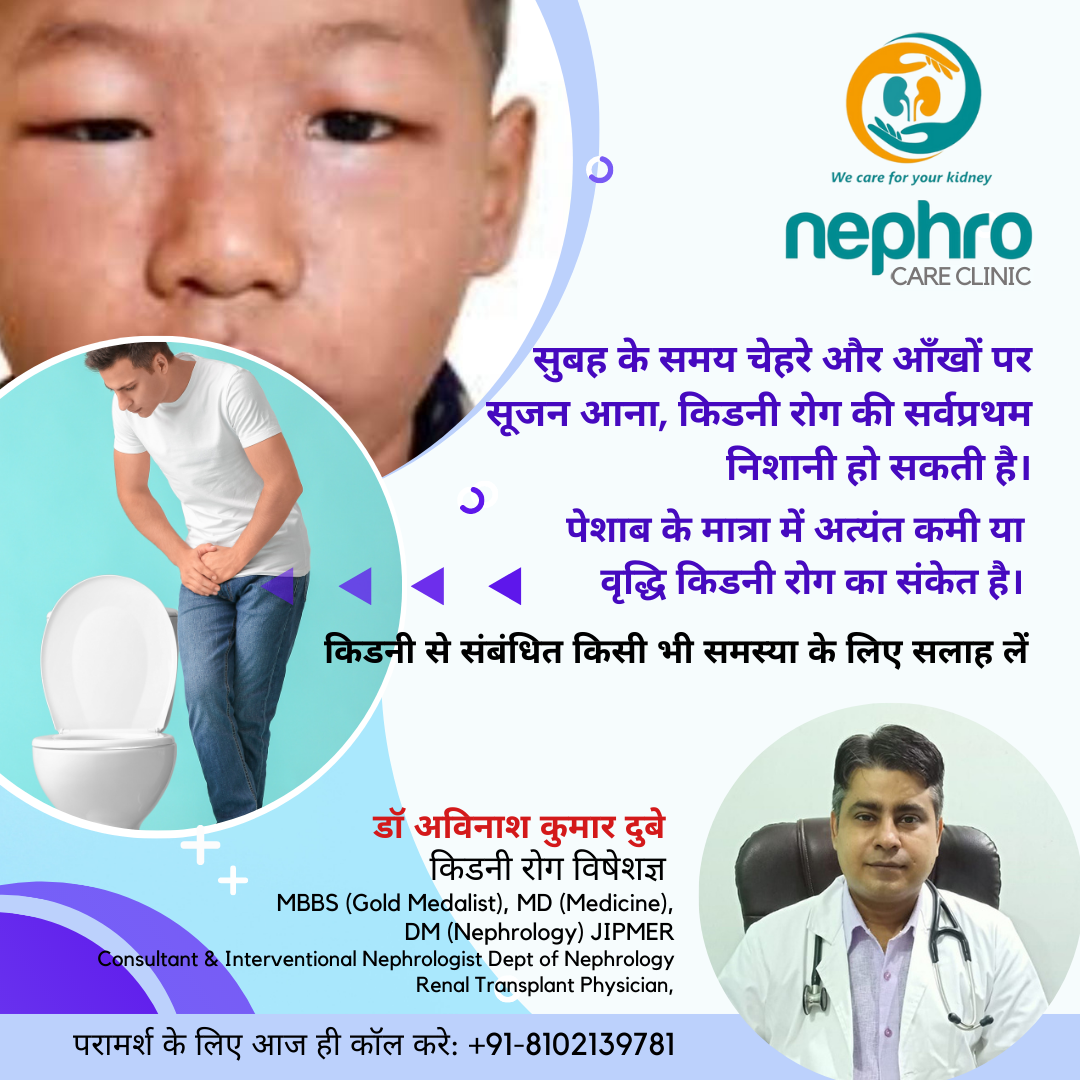 Dr Avinash Dubey nephro clinic 1